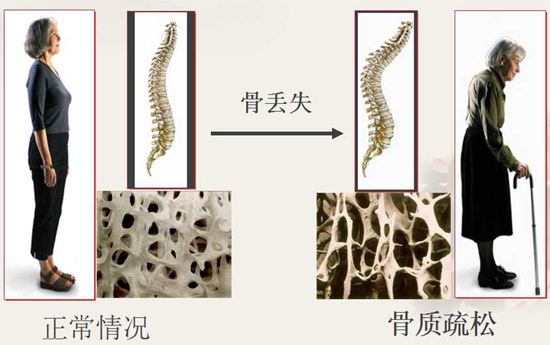 1595324382389979.jpg 20151023725288332934.jpg