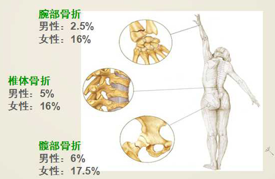 1595324470862527.jpg 20151023731362909259.jpg